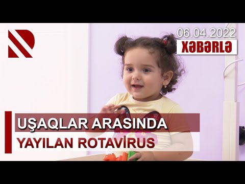Uşaqlar arasında yayilan rotavirus- -Hərarət, qusma və ishal virusun əsas simptomlarıdır